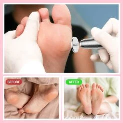 60 Pcs Replacement Sandpaper Discs With 25mm Metal Nail Drill Bit -Melody Susie 8 f87c4659 c8bc 4db8 83c9 fbf3b2e2e521